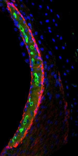 The chemotherapy drug cisplatin in a mouse inner ear