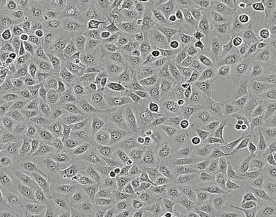 Vestibular schwannoma cells from an untreated tumor