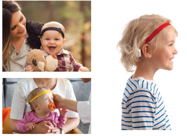 Examples of children wearing soft band bone conduction processors