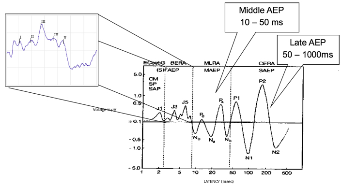 Overview of AEP in the time domain