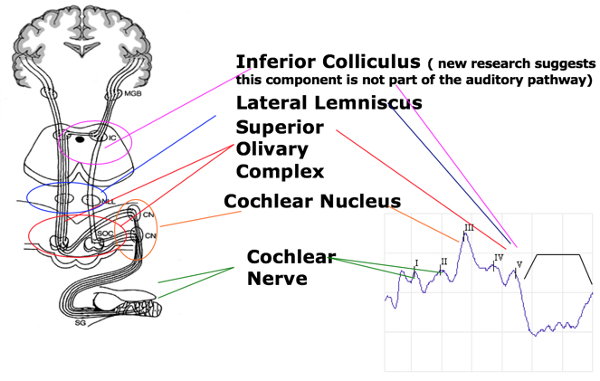 Anatomical and physiological principles of ABR