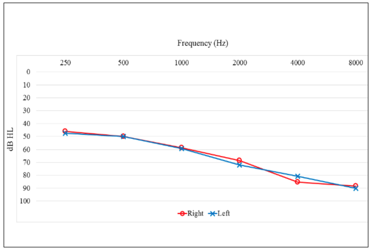 The mean audiometric thresholds of the participants in this study
