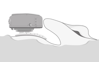 Correct positioning of ADHEAR