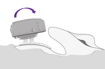Coupling ADHEAR to the adhesive adapter
