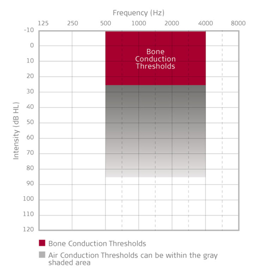 Bone conduction threshold