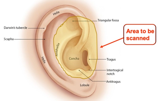 Area to be scanned by the Otoscan