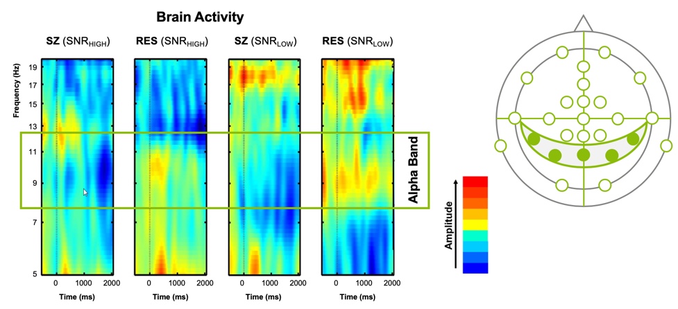 EEG results