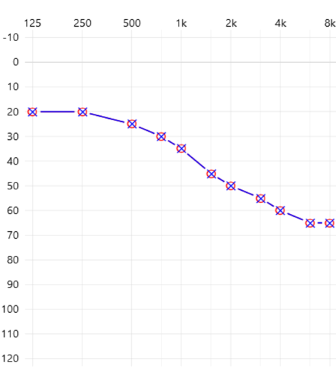 Scenario 1 Typical audiogram of first-time wearer of hearing aids