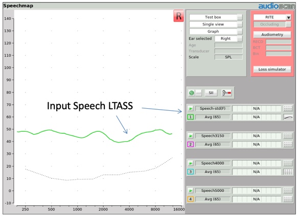 Long-term average speech spectrum for average speech