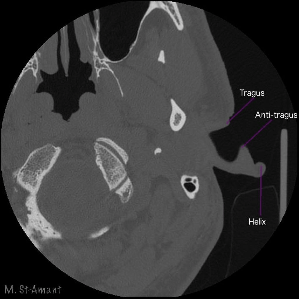CT scan example 1