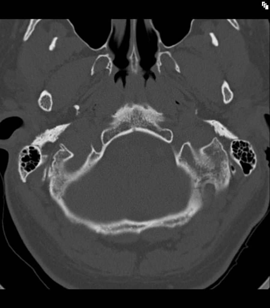 CT scan example 2