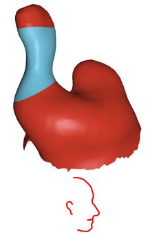 Right ear full scan with region seen in Figure 6A animation shown in blue
