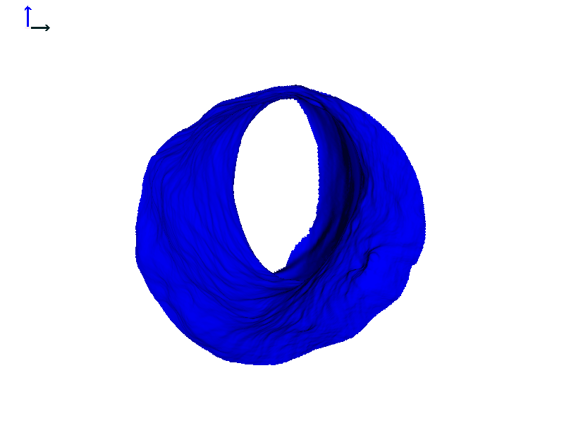 Heat map of expanding ear canal