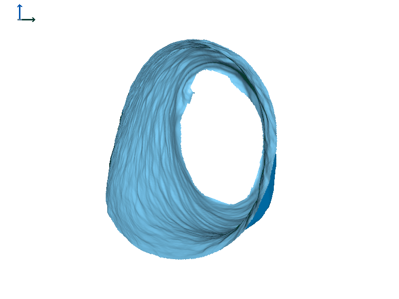 Subject 2 left ear