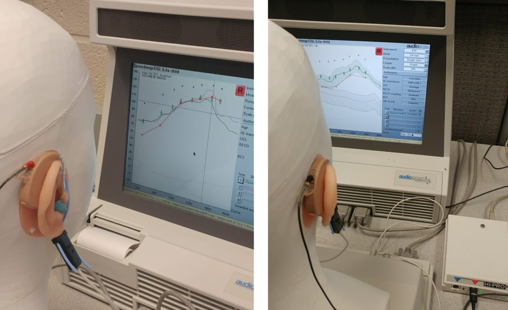 Two examples of high-gain hearing aid fittings in progress. 