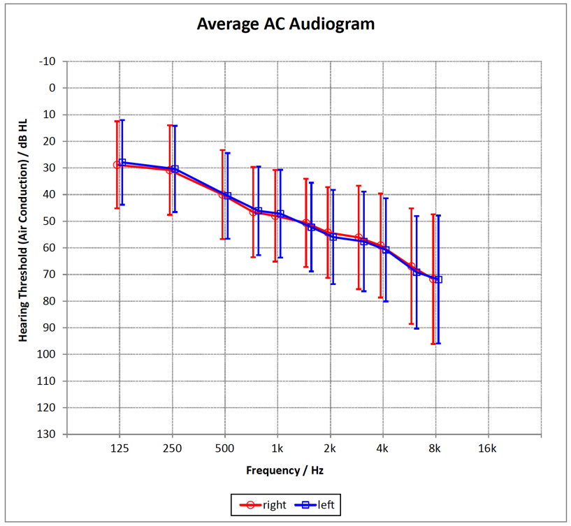 Mean hearing loss of the 30 subjects