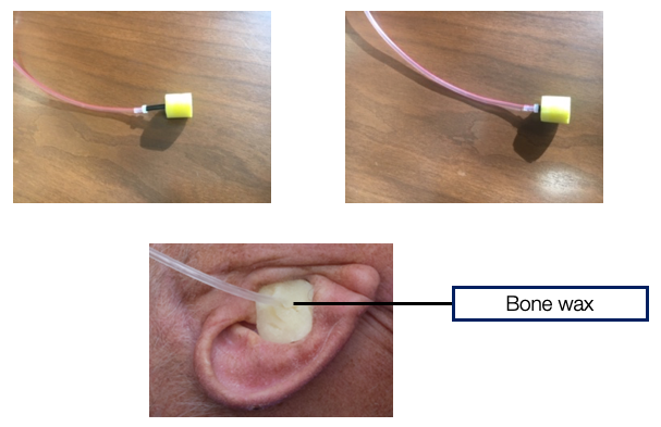 Insert earphone set up