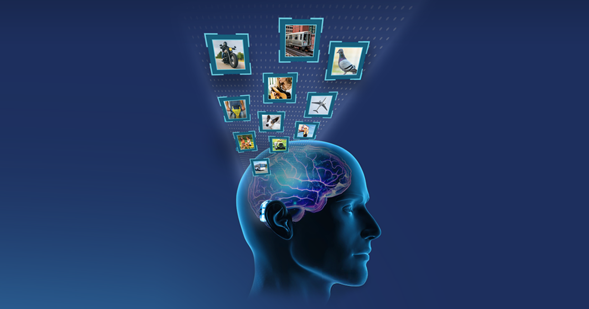 Oticon Deep Neural Network