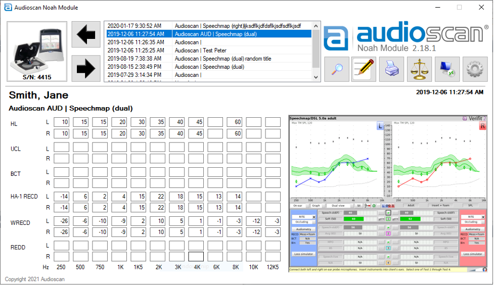 Audioscan actions in the NOAH module