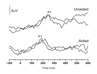 P1 CAEP waveforms as described in Figure 1 caption
