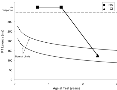 Averaged P1 CAEP latencies as described in Figure 2 caption