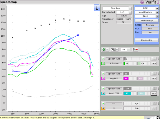 Simulated hearing aid output curves as described in figure 9 caption.