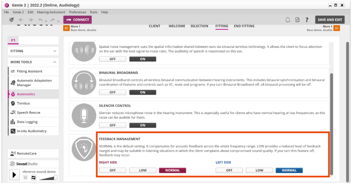 Oticon feedback cancellation screen.&nbsp;