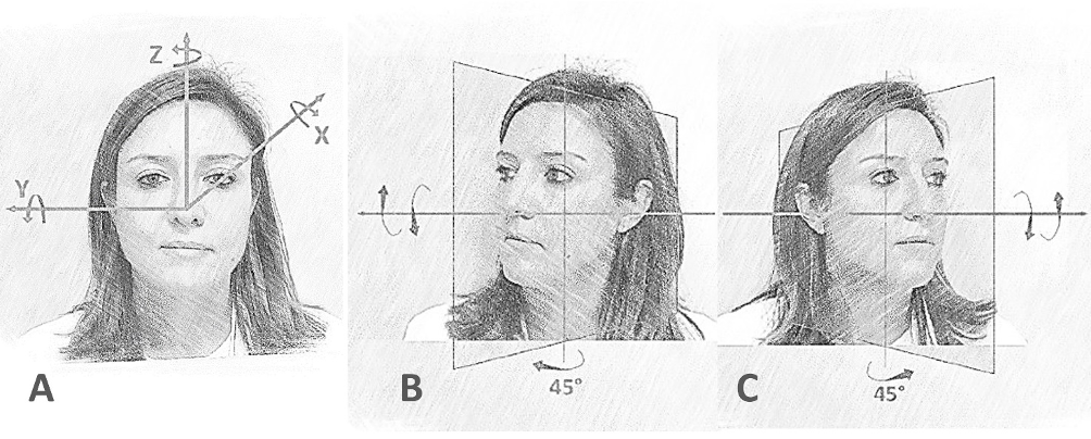 Schematic overview of head rotations along the X, Y and Z axes. Left anterior &ndash; right posterior (LARP)