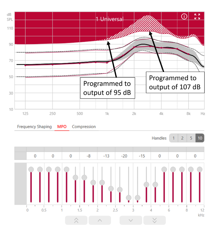 fIG 12
