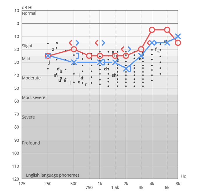 Figure1