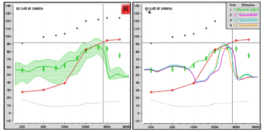 Figure 12