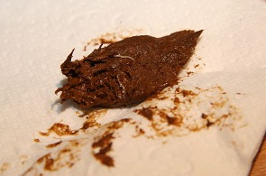 Pinworms in a stool sample.
