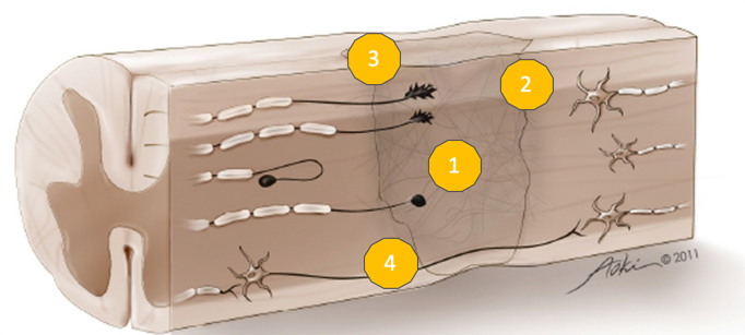 Spinal cord injury