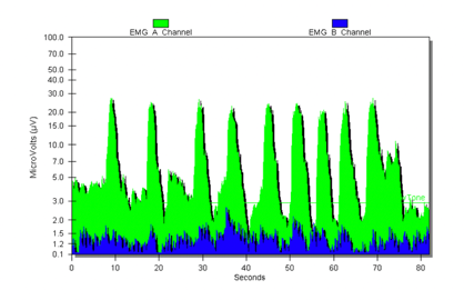 Biofeedback showing contraction and release of the pelvic floor muscles