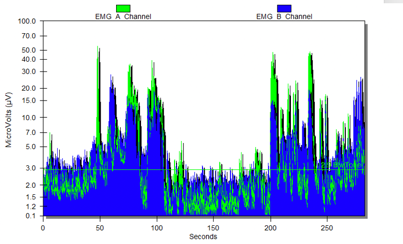 Dylan's first graph
