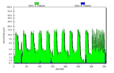 Dylan's second graph