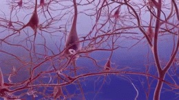 Beta-amyloid plaques and neurofibrillary tangles seen in Alzheimer's