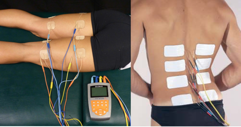 Examples of electrode shapes and sizes