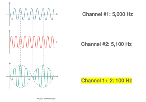 Second example of interferential current