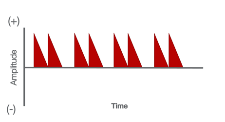 Example of a modified monophasic current