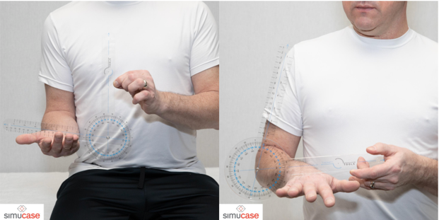 Supination and pronation with a goniometer