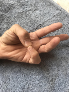 Thumb opposition