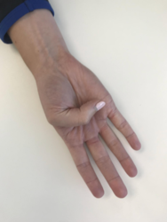 Flexion to the base of the 5th digit