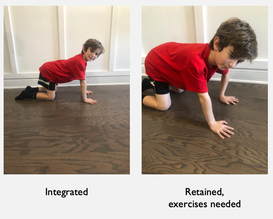 Testing for the ATNR reflex in quadruped