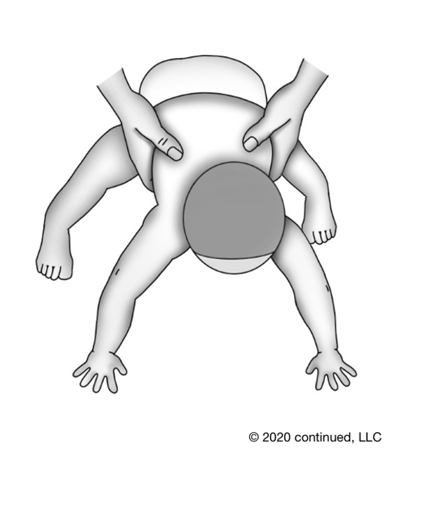 Testing position for the Spinal Galant reflex