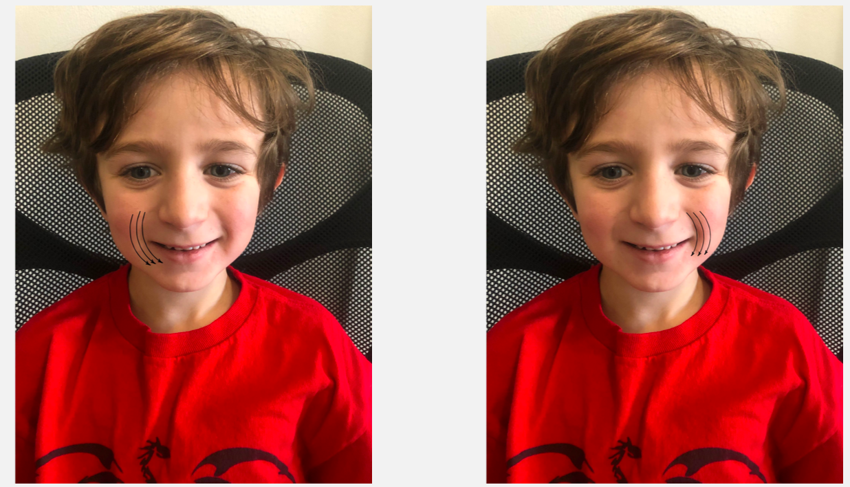 Testing for the rooting reflex