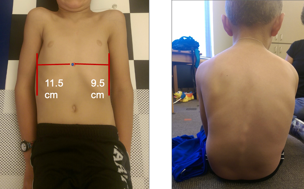 Figure 18