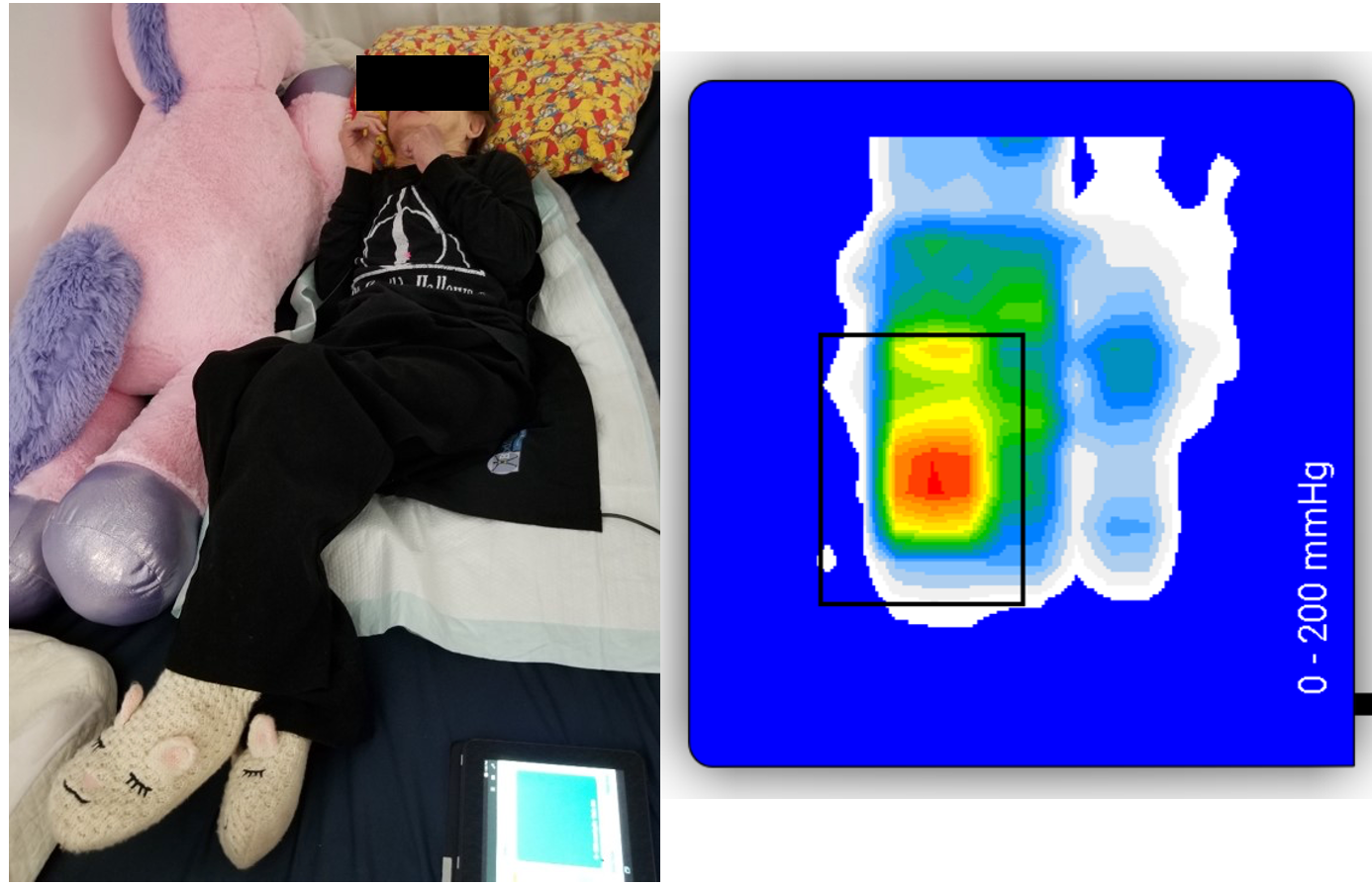Figure 28
