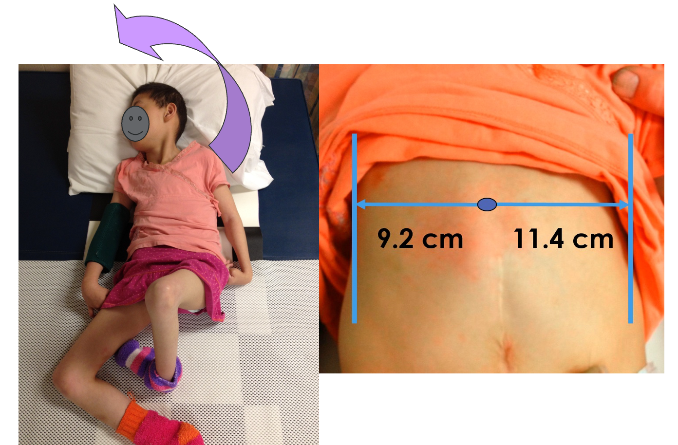 Figure 31