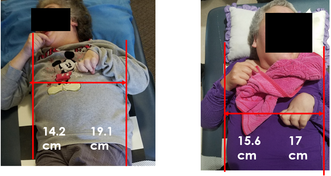 Figure 38